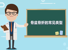 【醫(yī)療科普】骨盆骨折的常見(jiàn)類型有哪幾種？